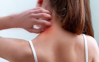 ¿Qué es la psoriasis del cuero cabelludo y cómo se puede tratar?